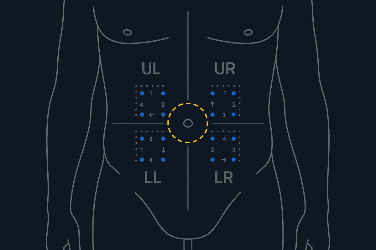 Abdomen injection site quadrants showing sub-zone rotation points with navel exclusion zone